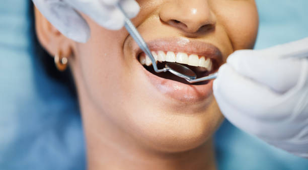 Best Emergency Root Canal Treatment in University Place, WA