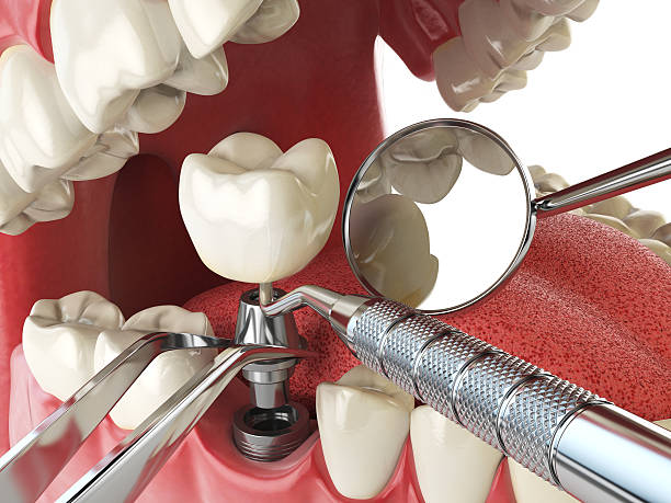 Best Emergency TMJ Treatment in University Place, WA